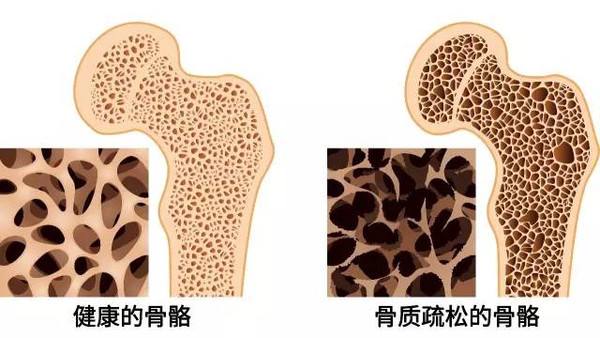 骨密度仪