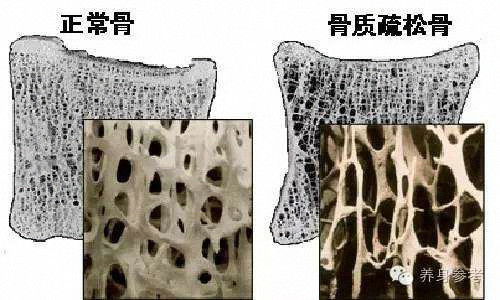 这么多小穴什么情况？不急来一个台骨密度仪检测检测